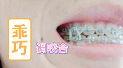 牙齿缺牙能戴牙套吗 西瓜视频